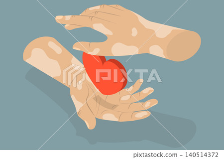 3D Isometric Flat Vector Illustration of Vitiligo, Leprosy-Affected Hands Supporting Heart Symbolize Care And Compassion. 3D Isometric Flat Vector Illustration of Vitiligo, Leprosy-Affected Hands Supporting Heart Symbolize Care And Compassion. 140514372