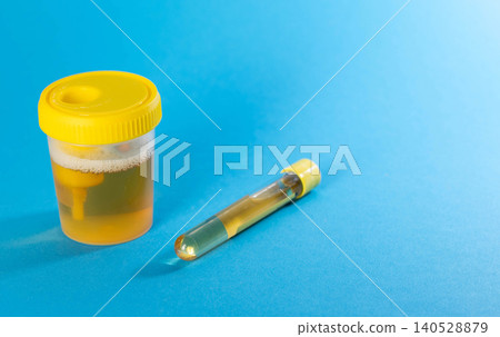 Transport tube with urine and culture reagent, blue background. Urine testing for infections causing urethritis and cystitis. Copy space for text Transport tube with urine and culture reagent, blue background. Urine testing for infections causing urethritis and cystitis. Copy space for text 140528879