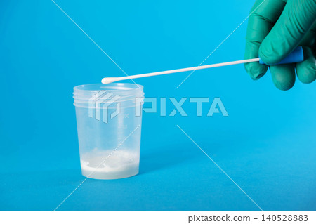 A laboratory technician's hand holds a medical swab against a background of ejaculate containing prostate fluid. Conceptual illustration of tests for sexually transmitted infections, chlamydia, and A laboratory technician's hand holds a medical swab against a background of ejaculate containing prostate fluid. Conceptual illustration of tests for sexually transmitted infections, chlamydia, and 140528883