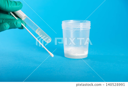 A laboratory technician's hand holds a medical swab against a background of ejaculate containing prostate fluid. Conceptual illustration of tests for sexually transmitted infections, chlamydia, and A laboratory technician's hand holds a medical swab against a background of ejaculate containing prostate fluid. Conceptual illustration of tests for sexually transmitted infections, chlamydia, and 140528991