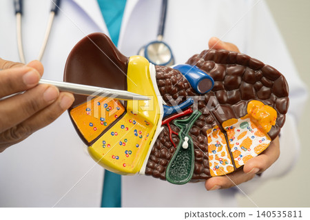 Cirrhosis, Liver cancer, fatty liver, Asian doctor with liver human model. 140535811