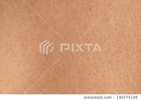 Many pores on brown human skin background Many pores on brown human skin background 140574108