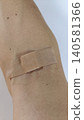 The arm from which blood was drawn 140581366