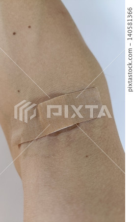 The arm from which blood was drawn 140581366