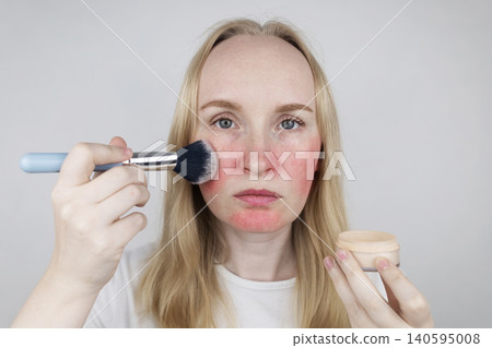 Blonde woman applying face powder to conceal skin redness, rosacea symptoms, or sunburn. Girl covering up damaged, irritated skin with cosmetic makeup brush. Blonde woman applying face powder to conceal skin redness, rosacea symptoms, or sunburn. Girl covering up damaged, irritated skin with cosmetic makeup brush. 140595008