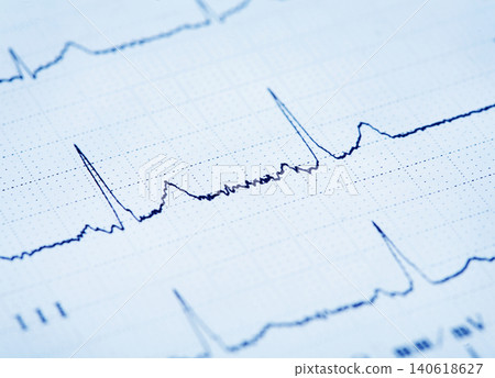 Close up of an electrocardiogram Close up of an electrocardiogram 140618627
