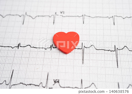 Electrocardiogram ECG, heart wave, heart attack, cardiogram report. Electrocardiogram ECG, heart wave, heart attack, cardiogram report. 140638576