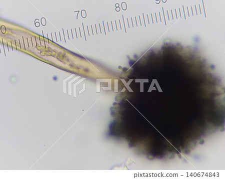 A photograph showing the size of conidia of Aspergillus oryzae. A photograph showing the size of conidia of Aspergillus oryzae. 140674843