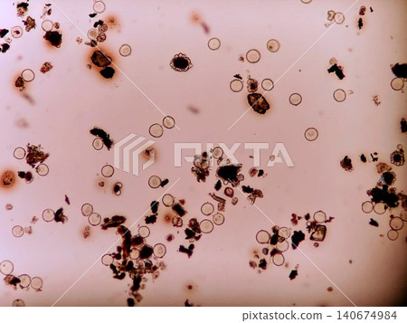 Dust and cedar pollen collected on the slide Dust and cedar pollen collected on the slide 140674984