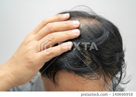 Bald in the middle head and begin no loss hair glabrous of mature Asian business smart active office man. Bald in the middle head and begin no loss hair glabrous of mature Asian business smart active office man. 140690958