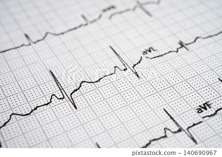 Red heart on electrocardiogram ECG with red heart, heart wave, heart attack, cardiogram report. Red heart on electrocardiogram ECG with red heart, heart wave, heart attack, cardiogram report. 140690967