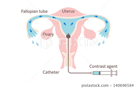 gynecology, vector, vectors 140696584