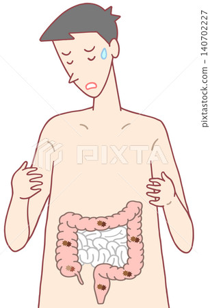 疾病、病症和病況-結腸癌、惡性腫瘤、結腸息肉 疾病、病症和病況-結腸癌、惡性腫瘤、結腸息肉 140702227