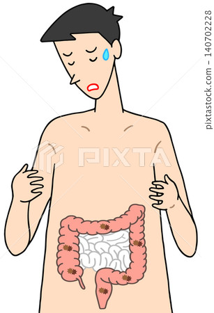 疾病、病症和病況-結腸癌、惡性腫瘤、結腸息肉 疾病、病症和病況-結腸癌、惡性腫瘤、結腸息肉 140702228