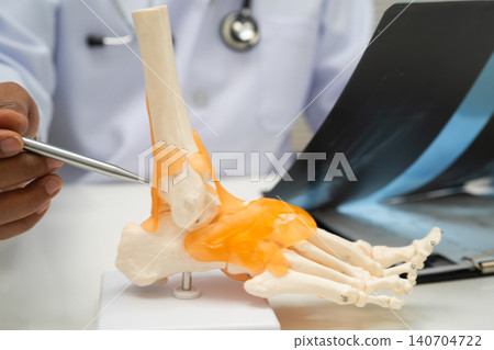 Doctor examining foot ankle joint bone radiography xray film. Doctor examining foot ankle joint bone radiography xray film. 140704722