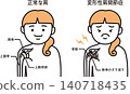 肩關節骨關節炎 140718435