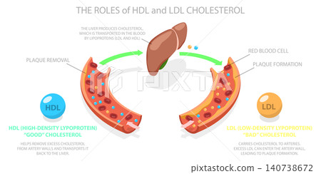 3D Isometric Flat Illustration of HDL And LDL Cholesterol, Transport And Plaque Formation Demonstrated With Visuals 3D Isometric Flat Illustration of HDL And LDL Cholesterol, Transport And Plaque Formation Demonstrated With Visuals 140738672
