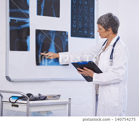 Senior doctor, woman and medical xray with clipboard for checklist, assessment and radiology for surgery. Lungs, cardiology and anatomy scan for healthcare with surgeon at treatment plan at clinic Senior doctor, woman and medical xray with clipboard for checklist, assessment and radiology for surgery. Lungs, cardiology and anatomy scan for healthcare with surgeon at treatment plan at clinic 140754275