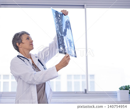 Woman, senior doctor and review xray for planning medical treatment, surgery and healthcare at hospital. Brain scan, neurology and radiology with surgeon for health assessment, anatomy and MRI Woman, senior doctor and review xray for planning medical treatment, surgery and healthcare at hospital. Brain scan, neurology and radiology with surgeon for health assessment, anatomy and MRI 140754954