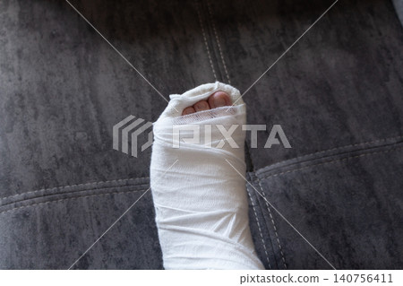 Cropped view of an injured teenager with a broken leg in a white orthopedic cast sitting on a gray sofa Cropped view of an injured teenager with a broken leg in a white orthopedic cast sitting on a gray sofa 140756411