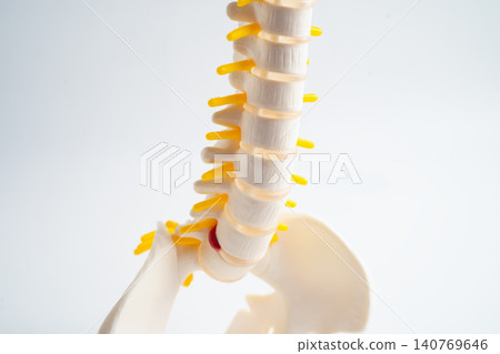 Lumbar spine, spinal nerve and human back bone. Lumbar spine, spinal nerve and human back bone. 140769646