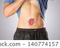Hernia symptoms shown in body illustration. 140774157