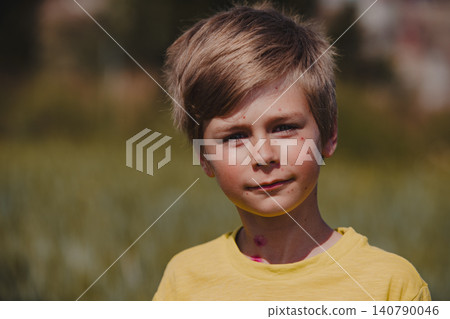 Outdoors portrait of boy with chicken pox 140790046