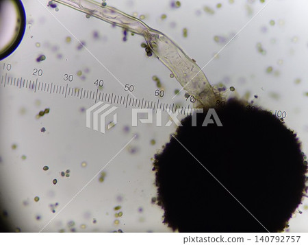 Microscopic photograph of Aspergillus species *Aspergillus*. 140792757