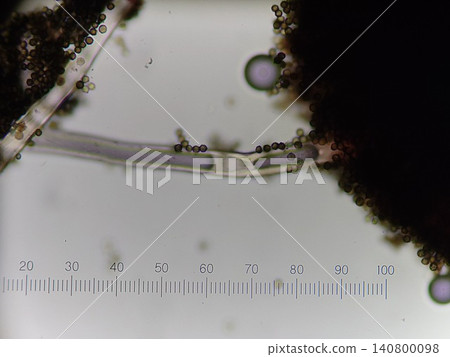 Conidiophores of Aspergillus oryzae Conidiophores of Aspergillus oryzae 140800098