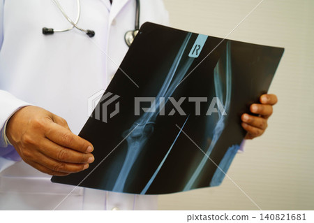 Doctor examining hand ankle joint bone radiography xray film. Doctor examining hand ankle joint bone radiography xray film. 140821681