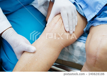 Doctor checking Asian elderly woman patient with scar knee replacement surgery in hospital. Doctor checking Asian elderly woman patient with scar knee replacement surgery in hospital. 140828186