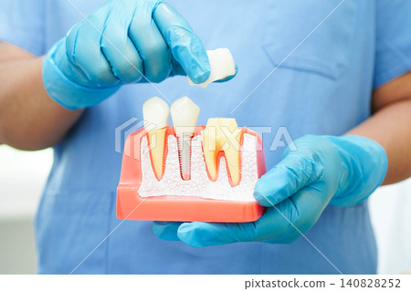 Doctor hold dental implant, artificial tooth roots into jaw, root canal of dental treatment, gum disease, teeth model for dentist studying about dentistry. Doctor hold dental implant, artificial tooth roots into jaw, root canal of dental treatment, gum disease, teeth model for dentist studying about dentistry. 140828252