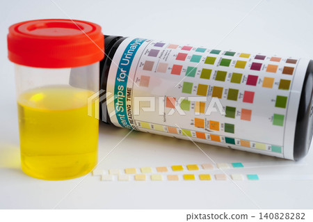 Urinalysis, urine cup with reagent strip pH paper test and comparison chart in laboratory. Urinalysis, urine cup with reagent strip pH paper test and comparison chart in laboratory. 140828282
