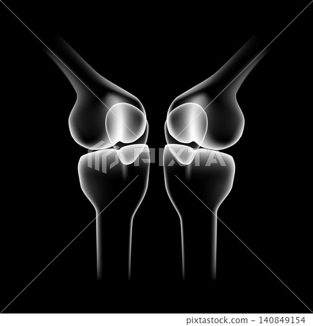 Human knee joint skeleton vector illustration isolated on black background. X-ray style side view of knee bones pair, anatomy femur patella tibia for medical poster, health care, arthritis design. Human knee joint skeleton vector illustration isolated on black background. X-ray style side view of knee bones pair, anatomy femur patella tibia for medical poster, health care, arthritis design. 140849154