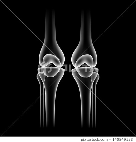 Human knee joint skeleton vector illustration isolated on black background. X-ray style side view of knee bones pair, anatomy femur patella tibia for medical poster, health care, arthritis design. Human knee joint skeleton vector illustration isolated on black background. X-ray style side view of knee bones pair, anatomy femur patella tibia for medical poster, health care, arthritis design. 140849158