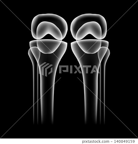 Human knee joint skeleton vector illustration isolated on black background. X-ray style side view of knee bones pair, anatomy femur patella tibia for medical poster, health care, arthritis design. Human knee joint skeleton vector illustration isolated on black background. X-ray style side view of knee bones pair, anatomy femur patella tibia for medical poster, health care, arthritis design. 140849159