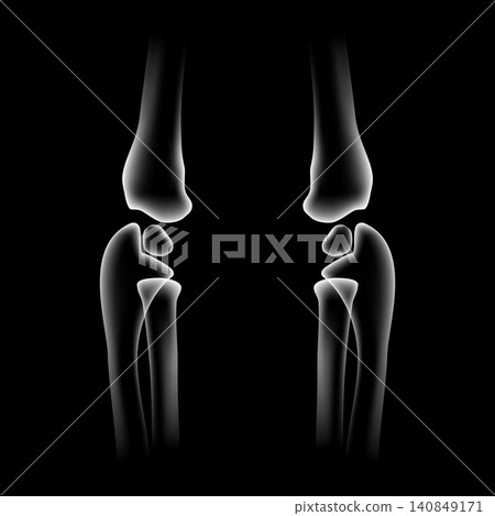 Human elbow joint skeleton vector illustration isolated on black background. X-ray style front view of elbow bones pair, anatomy humerus radius ulna for medical poster, arm care, health design. Human elbow joint skeleton vector illustration isolated on black background. X-ray style front view of elbow bones pair, anatomy humerus radius ulna for medical poster, arm care, health design. 140849171