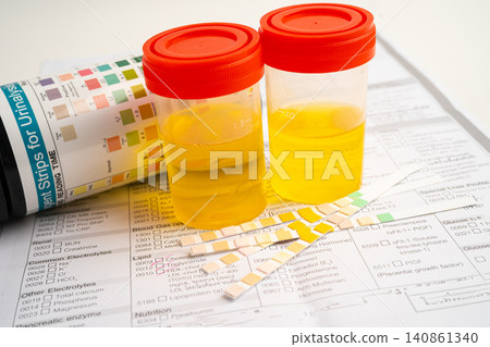 Urinalysis, urine cup with reagent strip pH paper test and comparison chart in laboratory. Urinalysis, urine cup with reagent strip pH paper test and comparison chart in laboratory. 140861340