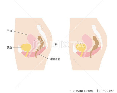 女性骨盆橫切面示意圖(子宮、膀胱、腸道、骨盆底肌肉) 女性骨盆橫切面示意圖(子宮、膀胱、腸道、骨盆底肌肉) 140899468