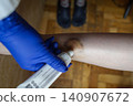 Doctor in blue gloves treating a large bruise and hematoma on a child leg. Medical care, first aid and treatment for pediatric skin injury or contusion. Doctor in blue gloves treating a large bruise and hematoma on a child leg. Medical care, first aid and treatment for pediatric skin injury or contusion. 140907672