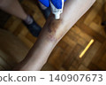 Doctor in blue gloves treating a large bruise and hematoma on a child leg. Medical care, first aid and treatment for pediatric skin injury or contusion. Doctor in blue gloves treating a large bruise and hematoma on a child leg. Medical care, first aid and treatment for pediatric skin injury or contusion. 140907673