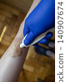 Doctor in blue gloves treating a large bruise and hematoma on a child leg. Medical care, first aid and treatment for pediatric skin injury or contusion. Doctor in blue gloves treating a large bruise and hematoma on a child leg. Medical care, first aid and treatment for pediatric skin injury or contusion. 140907674