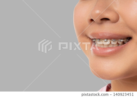A woman shows her smile with braces while relaxing at a spa A woman shows her smile with braces while relaxing at a spa 140923451