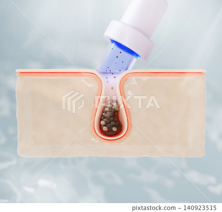 Vacuum pore cleaner removes blackhead on skin. Facial cleaning black dots suction exfoliating acne pimple tool, microdermabrasion machine render icon. Cosmetic procedure, beauty care. 3D illustration Vacuum pore cleaner removes blackhead on skin. Facial cleaning black dots suction exfoliating acne pimple tool, microdermabrasion machine render icon. Cosmetic procedure, beauty care. 3D illustration 140923515