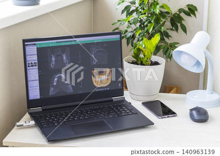 Dental cone beam computed tomography or CBCT diagnostic scan software displaying multi-planar views and a 3D maxillofacial reconstruction model. Healthcare 140963139