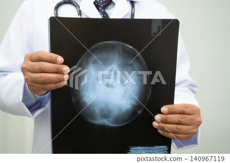 Doctor examining brain radiography xray film. 140967119