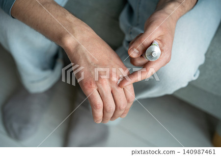 Hand care treatment and cold weather in winter season, man applying cosmetic cream to heal sore skin Hand care treatment and cold weather in winter season, man applying cosmetic cream to heal sore skin 140987461