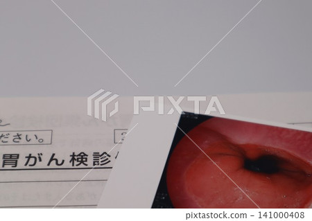 胃癌篩查影像 胃癌篩查影像 141000408