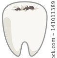 Illustration of a tooth with decay 141011389