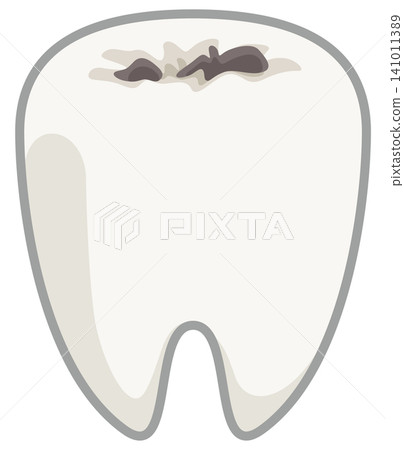 Illustration of a tooth with decay 141011389
